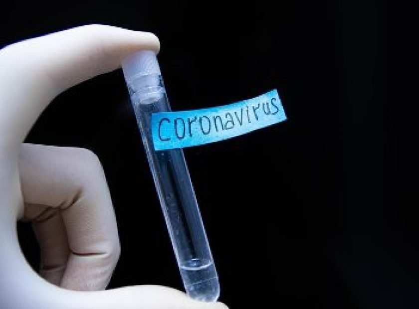 CORONOVIRUS_F9884